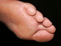 Secretary sweaty feet after work