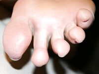 Secretary sweaty feet after work