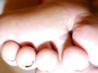 Secretary sweaty feet after work