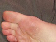 Freckled Feet - 3044