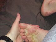 Freckled Feet - 3044