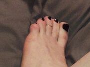 Freckled Feet - 3044