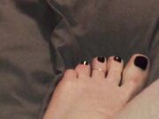 Freckled Feet - 3044