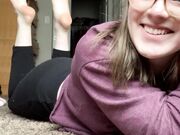 Freckled Feet - 3424