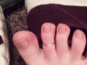 Freckled Feet - 5325