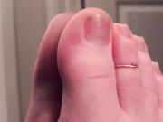 Freckled Feet - 5325