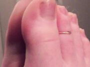 Freckled Feet - 5325