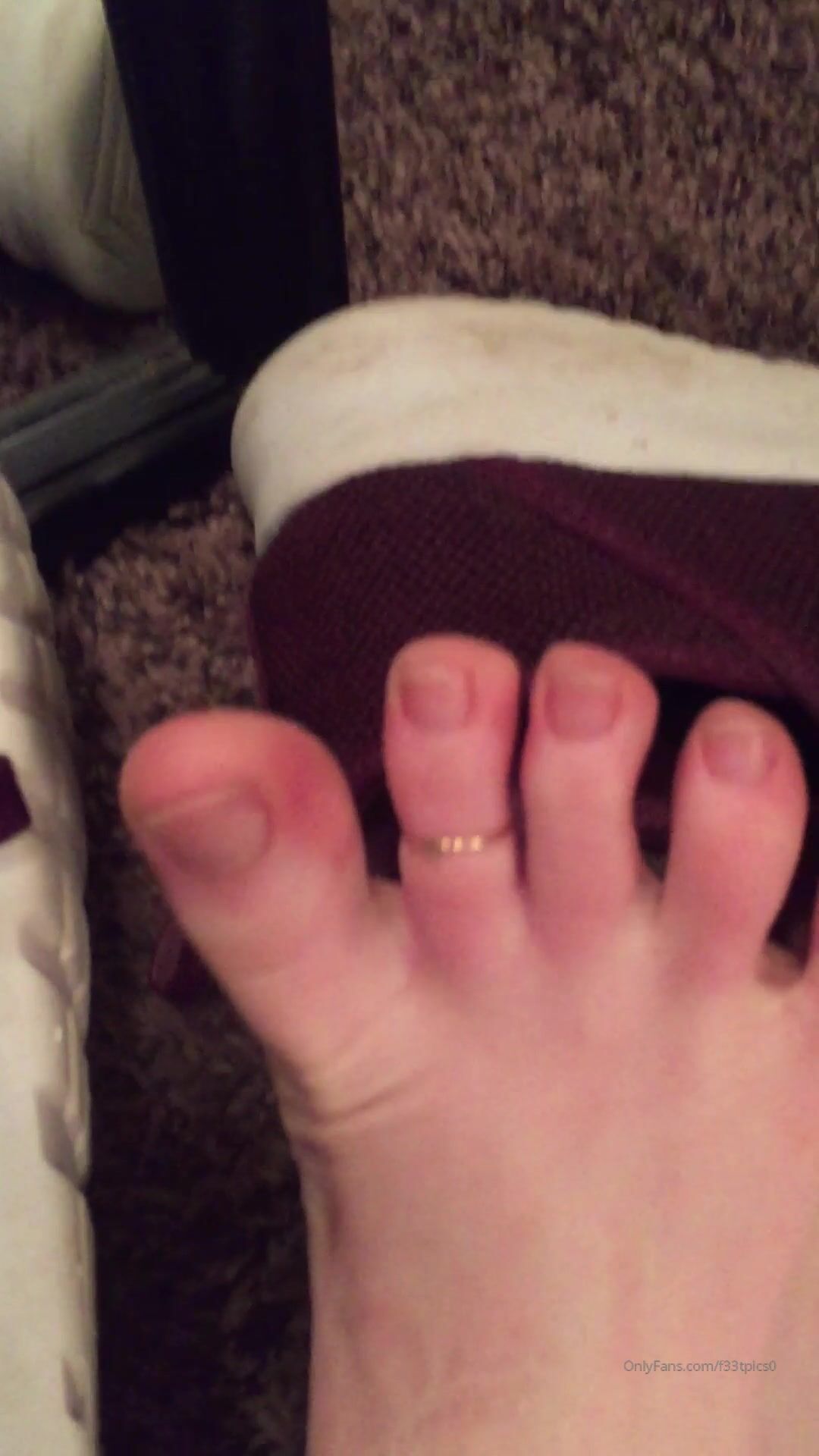 Freckled Feet - 5325