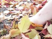 Freckled Feet - 5632