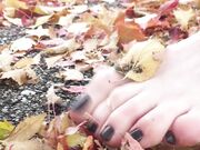 Freckled Feet - 5632