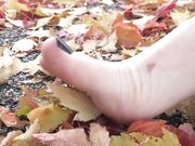 Freckled Feet - 5632