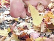 Freckled Feet - 5632