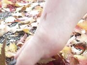 Freckled Feet - 5632