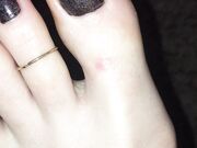 Freckled Feet - 5634