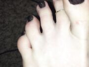 Freckled Feet - 5634