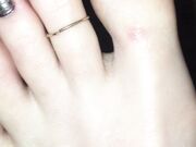 Freckled Feet - 5634