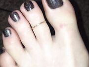 Freckled Feet - 5634