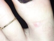 Freckled Feet - 5634