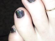 Freckled Feet - 5634