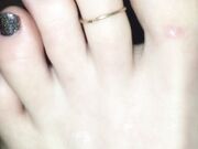 Freckled Feet - 5634