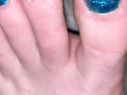 Freckled Feet - ARNING  TOE JAM CONTENT AHEAD. Look away if 