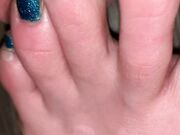 Freckled Feet - ARNING  TOE JAM CONTENT AHEAD. Look away if 