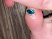 Freckled Feet - ARNING  TOE JAM CONTENT AHEAD. Look away if 