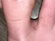 Freckled Feet - ARNING  TOE JAM CONTENT AHEAD. Look away if 