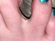 Freckled Feet - ARNING  TOE JAM CONTENT AHEAD. Look away if 