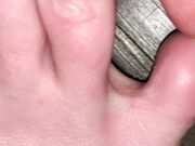 Freckled Feet - ARNING  TOE JAM CONTENT AHEAD. Look away if 