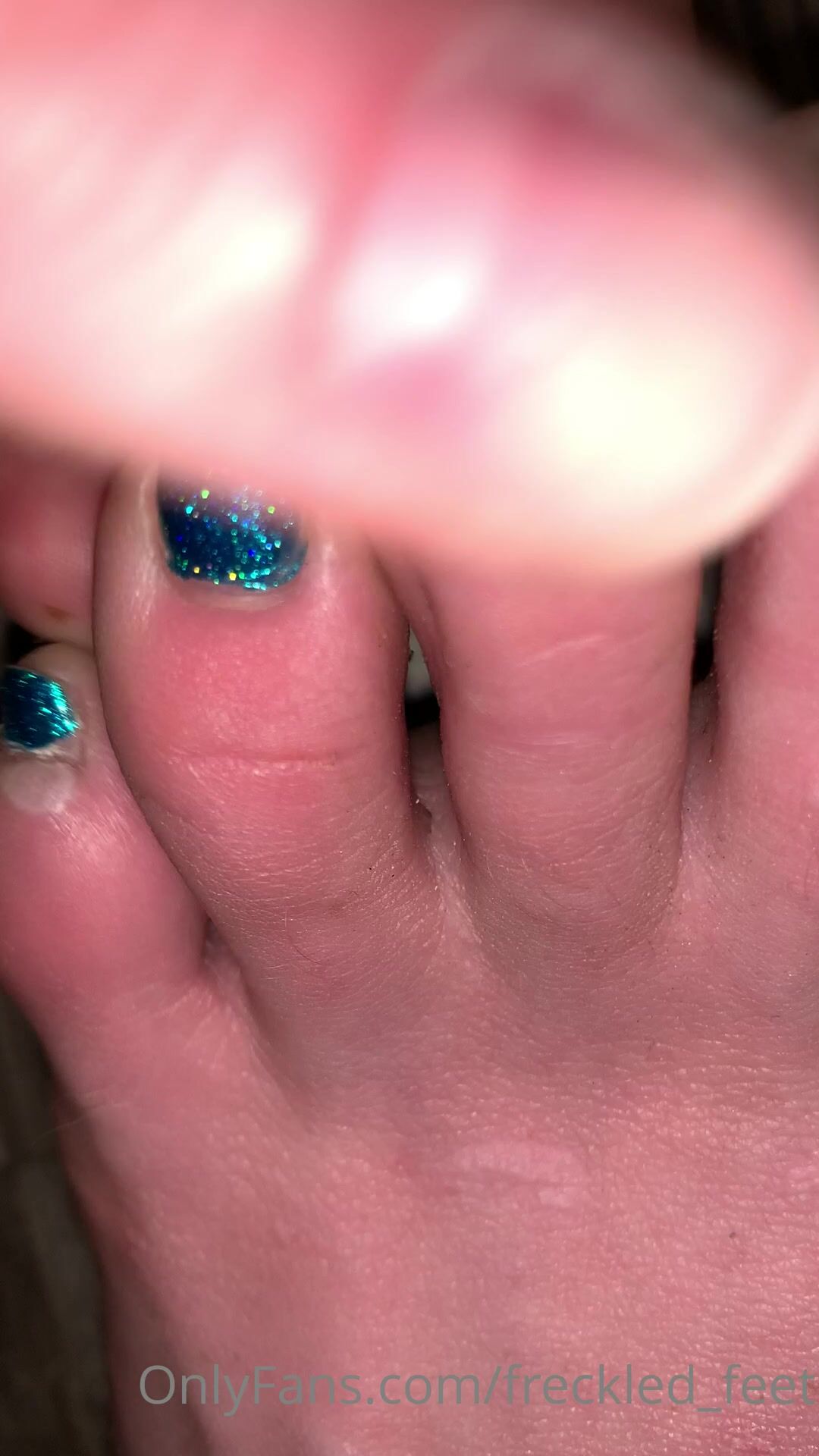 Freckled Feet - ARNING  TOE JAM CONTENT AHEAD. Look away if 