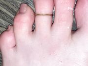 Freckled Feet - elp me clean them off5415