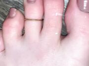 Freckled Feet - elp me clean them off5415