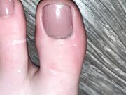 Freckled Feet - elp me clean them off5415