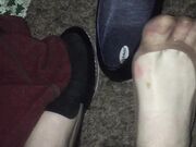 Freckled Feet - is work week is kicking my ass  When I took 