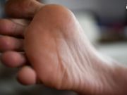 Czech Soles - Sprained ankle and sexy foot worship