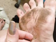 Filthy feet and long nails
