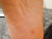 Meaty soles close up 1